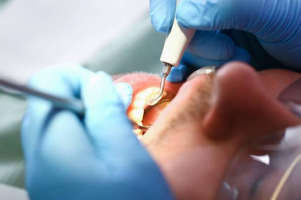Best Emergency Treatment for Oral Infections in Schleswig, IA