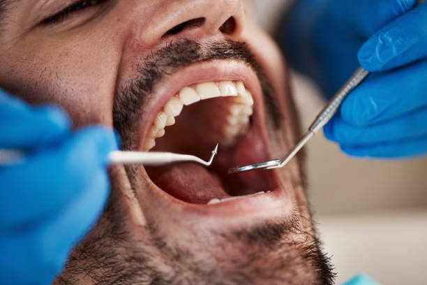 Professional Emergency Dental Service in IA